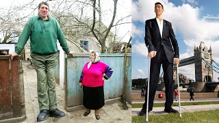 The TALLEST PEOPLE In The World [upl. by Ertemed]