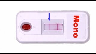 Rapid Mono Test How Does it Work [upl. by Noremac424]