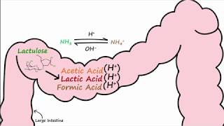 Hepatic Encephalopathy and Lactulose [upl. by Haimerej927]