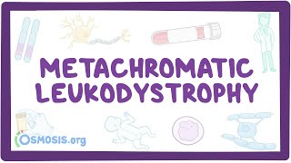 Metachromatic leukodystrophy  causes symptoms diagnosis treatment pathology [upl. by Ahon860]