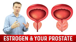 How To Fix Enlarged Prostate Explained By Dr Berg [upl. by Filberto]