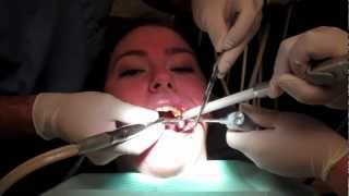 What Is It Like To Get A Filling In Your Tooth With Footage From The Dentists Office [upl. by Janerich]