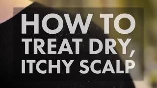 How to Treat a Dry Itchy Scalp  WebMD [upl. by Willumsen]