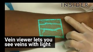 Vein Viewer [upl. by Uhayile725]