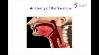 Stroke Education  Dysphagia [upl. by Inahc]