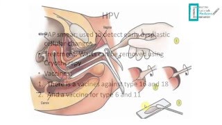 STDs Overview [upl. by Maynard]