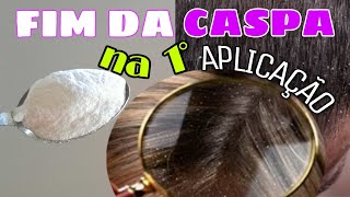 MELHOR REMEDIO CASEIRO PRA ACABAR DE VEZ COM A CASPA  end of dandruff [upl. by Annnora944]