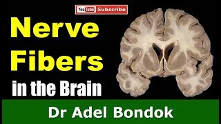 Commissural Association and Projection Fibers in the Brain Dr Adel Bondok [upl. by Aerbas265]