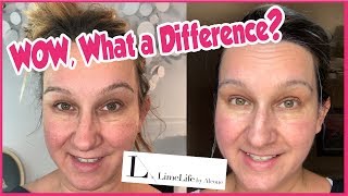 Limelife by Alcone Skincare Review [upl. by Amadeus130]