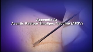 Appendix A Aventis Pasteur Smallpox Vaccine APSV [upl. by Atikahc]