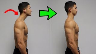 FIX Forward Head Posture Daily Corrective Routine [upl. by Otreblasiul]