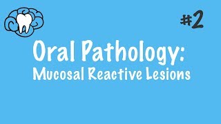 Oral Pathology  Mucosal Malignant Lesions  INBDE ADAT [upl. by Aleece]