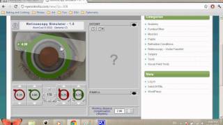 Retinoscopy Simulator Tutorial SPHCYL Method [upl. by Terle]