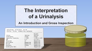 Interpretation of the Urinalysis Part 1  Introduction and Inspection [upl. by Anavoig]