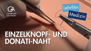 Einzelknopf und DonatiNaht [upl. by Rame77]