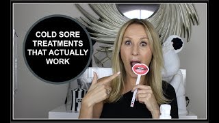 COLD SORE TREATMENTS THAT WORK  NADINE BAGGOTT [upl. by Aizatsana957]