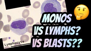 How I distinguish between Lymphocytes vs Monocytes [upl. by Sidwell]