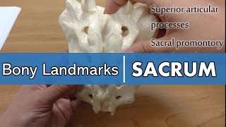 Bony Landmarks of the Sacrum [upl. by Mychal]