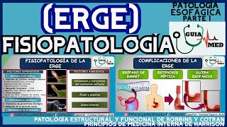 ENFERMEDAD POR REFLUJO GASTROESOFÁGICO FISIOPATOLOGÍA  GuiaMed [upl. by Ecnedurp]