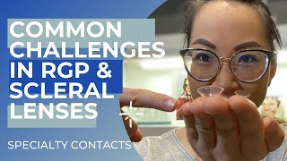 Specialty Contact Lenses Common Challenges [upl. by Thalassa893]