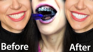 Fastest Way To Whiten Teeth At Home What REALLY Works [upl. by Nyrac364]